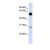 Western Blot: 14-3-3 zeta Antibody [NBP1-56672] - This Anti-YWHAZ antibody was used in Western Blot of Fetal Lung tissue lysate at a concentration of 1ug/ml.